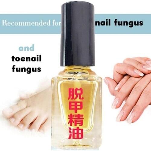 Effective Fungus Removal Essence oil Liquid Fungal Nail Treatment Bright Nail Repair Anti Infection Foot Caring Onychomycosis