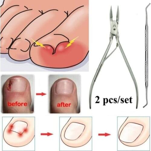 Ingrown Finger Toe Nail Correction Nippers Nail Clipper Cutters Dead Skin Dirt Remover + Paronychia Podiatry Pedicure Nail Tool