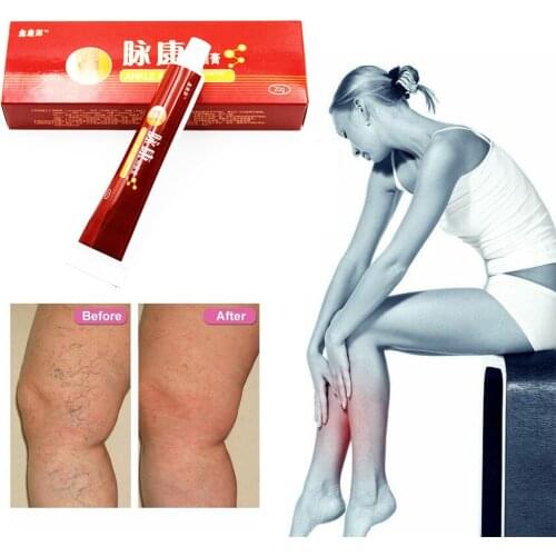 20g Varicose Veins Treatment Cream Ointment Vasculitis Inflammation Chinese Herbal Leg Massage Varicose Veins Removal Plaster