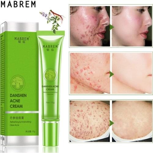 15g Effective Salvia Acne Treatment Cream Oil Control Shrink Pores Acne Scar Removal Cream Face Skin Care Cream