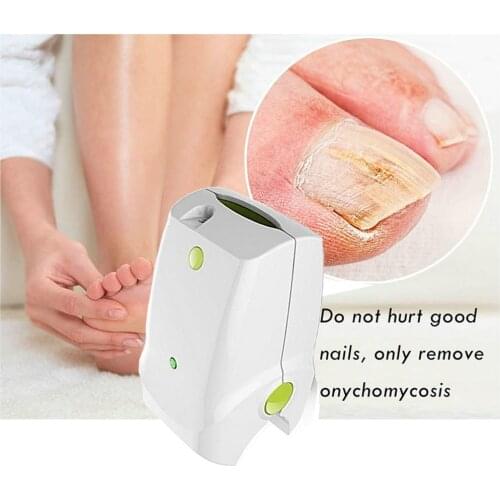 Hot Selling Painless Nail Fungus Laser Device With 905nm Laser For Nail Fungus Treatment, Laser For Onychomycosis