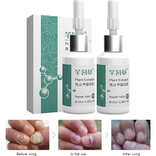 FGHGF Nail Oils
