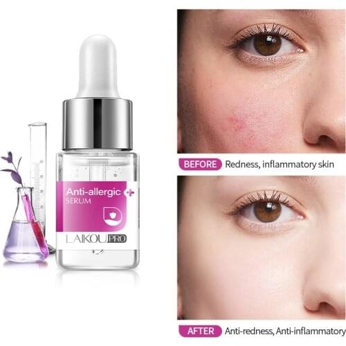 Anti-allergic Serum Chinese Herbal Anti-sensitive Anti-redness Facial Essence Shrink Pores Soothe Skin Treat Acne Face Serum