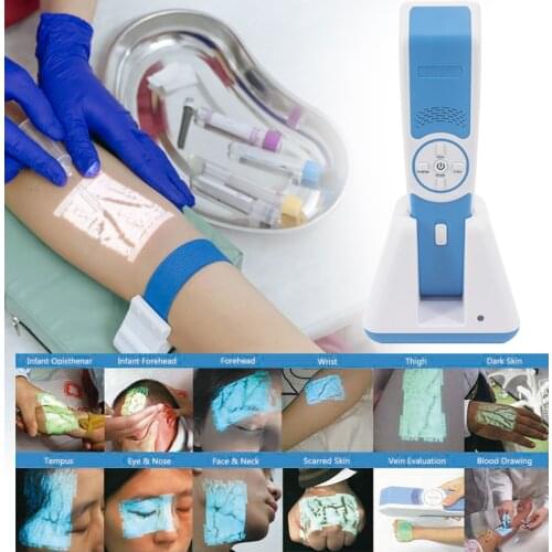Near-infrared light Source Type and cheap vein finder Product name new vein viwer