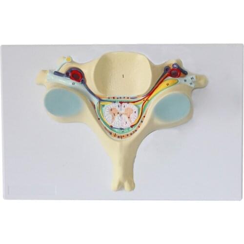 Fifth Cervical Vertebra Spinal Cord and Spinal Nerve Magnification Model Nerve Enlargement Spinal Nerve Model