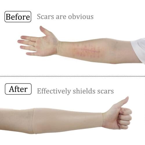 ONEFENG Arm Scar Tattoo Birthmark Obscuration Silicone Sleeve Arm Fattening Thickening Bold Modification