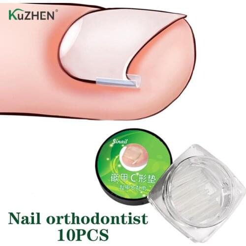 10PCS Relief Pain Nail Correction Devices Correction Ingrown Pads Nail Corrector Treatments Sticker Patch Foot Care Tools