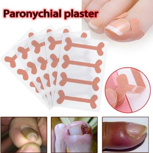 Ingrown Toenails Band Aid Relief Pain Paronychia Correction Pedicure Elastic Force Sticker Repair Bandage Toe Nail Care