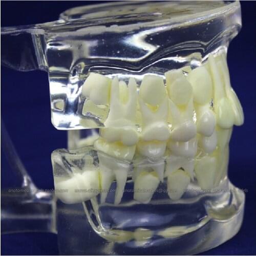 CMAM/12602 Dental- celar Children dentition, Human Oral Dental Medical Teaching Anatomical Model