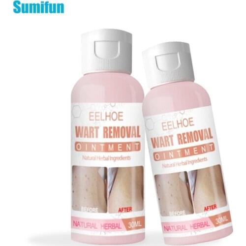 1pcs Skin Tags Warts Remover Ointment Common Corn Wart Treatment Herbal Extract Plaster Antibacterial Cream Body Skin Care P0233