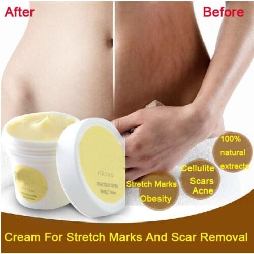 Thailand pasjel precious Skin Body Cream stretch marks remover scar removal powerful postpartum obesity pregnancy cream