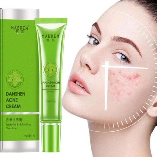 15g Acne Treatment Face Cream Remove Acne Oil Control Shrink Pores Nourishing Moisturizing Whitening Cream Skin Care