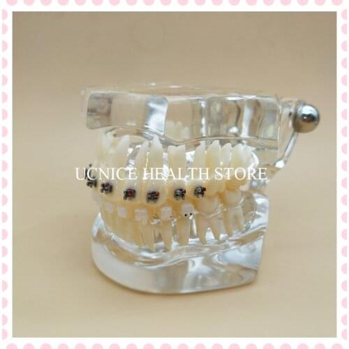 Dental Orthodontic Teeth Model with bracket M3003/Education Teeth model M3003/dental brace model