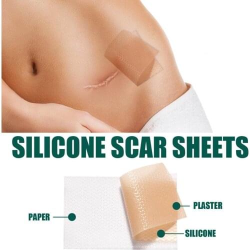 Scar Sticker Easy to Use Long Lasting Fabric Acne Trauma Burn Scar Removal Sheet for Pregnant Woman
