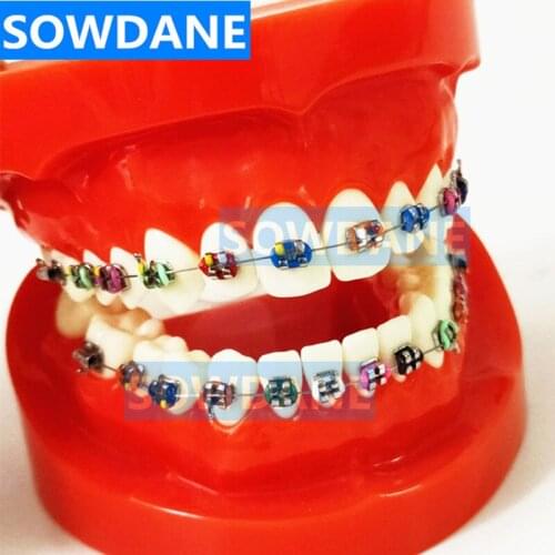 Dental Orthodontic Teaching Studying Model With Ortho Metal Bracket Arch Wire Buccal Tube Ligature Ties Adult Standard Red Model