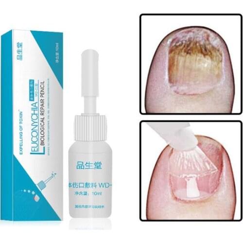 10ml Nail Fungus Treatment Nail Repair Liquid Armor Sterilization Treatment Onychomycosis Remover Nail Care Tool TSLM1