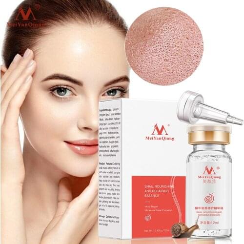MeiYanQiong Snail Essence Hyaluronic Acid Liquid Whitening Spot Shrink Pores Ampoule Anti-acne&wrinkle Regenerative Essence