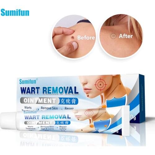 Sumifun 20g Herbal Extraction Warts Remover Ointment Wart Treatment Cream Skin Tag Remover Foot Corn Antibacterial Ointments