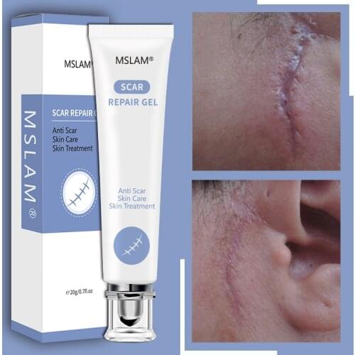 Scar Repair Gel Removal Scar Acne Cream Treatment Marks For Face Body Pigmentation Corrector Skin Korean Cosmetics