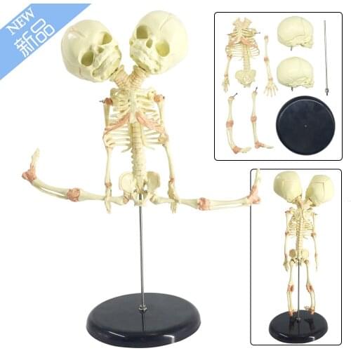 38cm Human Double Head Baby Skull Skeleton Model Anatomy Brain Display Study Teaching Anatomical Model