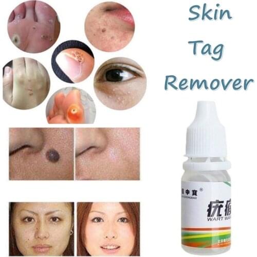 Skin Tag Mole Wart Remover Eye Skin Tag Remover 12 Hours Cleansing Swabs Adult Mole Wart Face Care 10ml