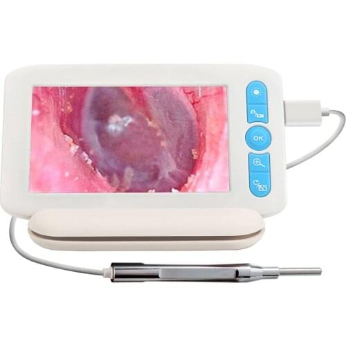 Digital Otoscope with 6 LEDs Lights 1080P High Definition Ear Scope Camera 4.3in IPS Screen Earwax Removal Tool and Specula