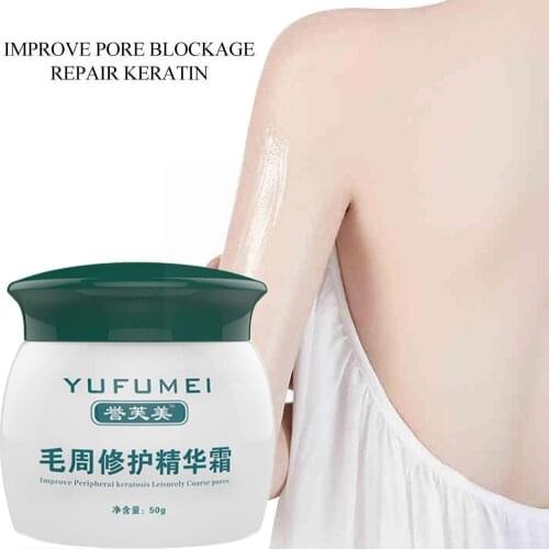 50g Curing Keratosis Pilaris/ Kp/ Chicken Skin Body And Repair Cream Skin Care Moisturizing Essence Nourishing Skin Lotion S6A3