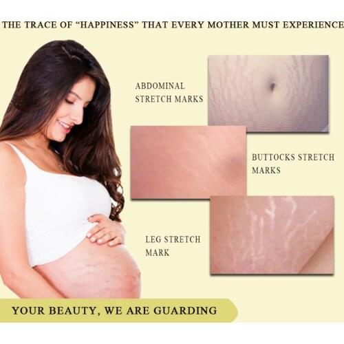 Крема от растяжек SI MI DA DANG China At AliExpress