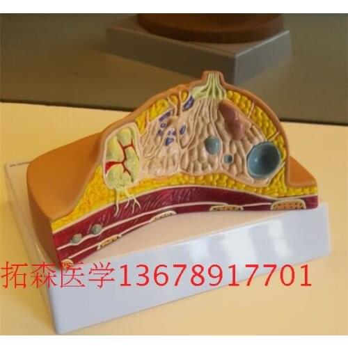 Human organ Model Breast Pathology Model Breast Anatomy free shipping