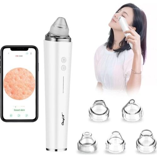Potable Face Suction Blackhead Acne Wrinkle Remover Microdermabrasion Diamond Peeling Machine Beauty Spa Massage with 6 Tips