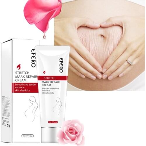Stretch Marks Repair Cream Remove Pregnancy Scars Treatment Maternity Anti Wrinkle Anti Aging Winkles Firming Body Creams