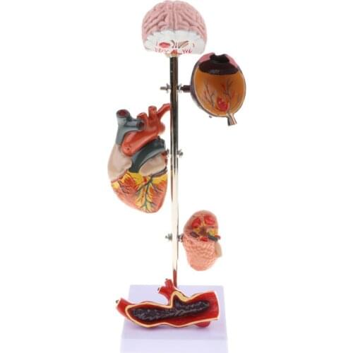 Hypertension Organ Model 5 Anatomical Parts of Eye Organ Auditory Renal Artery Internal Organs Model Human Body Teaching Model