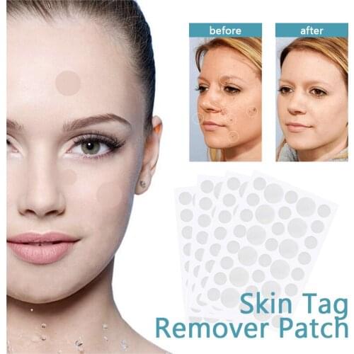 36pcs Skin Tag Remover Warts Remover Patch Wart Treatment Cream Herbal Extract Foot Corn Plaster Acne Warts Ointment