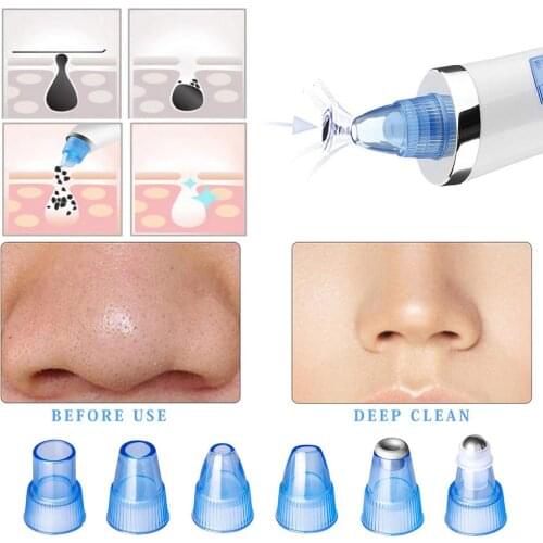 Electric Blackhead Remover Facial Grease Acne Pores Cleaner Extractor USB Charging Beauty Instrument for Women Men