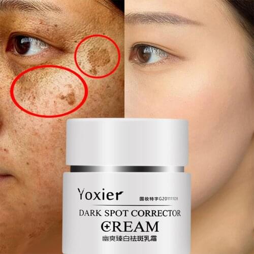 Face Cream Yoxier Dark Point Correction Anti-aging Bleaching Moisturizer Remove Sun Burns Dark Spots And Pigmentation Acne 30g