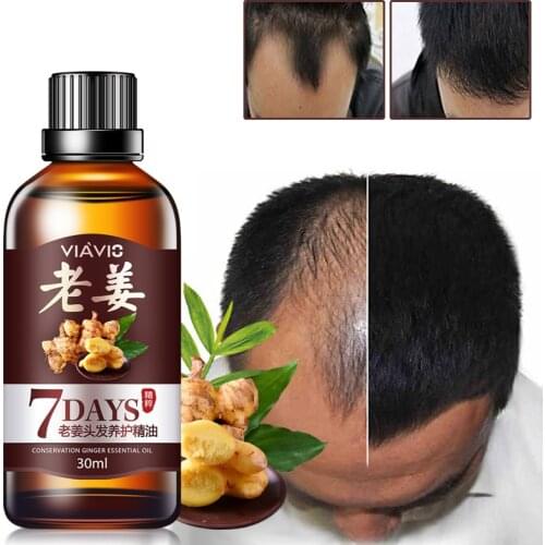 30ML Effective Hair Growth Ointment Hair Care Healthy Growth Essence Oil Hair Loss Care Dense Hair Growth Serum