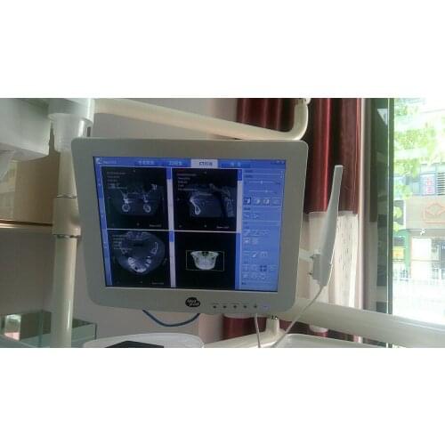 2019 New Dental Touch screen capacitive monitor with intraoral camera built in Intel/Windows10 tools