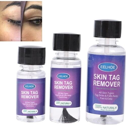 Remover Warts Removal Relief Medical Treatment Meat Corn Skin Flat Wart Antibacterial Liquid Foot Calluses Skin Care Cream