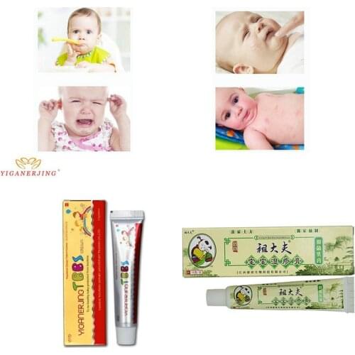 With Box Zudaifu Baby Psoriasis Cream Dermatitis Eczematoid Eczema Treatment Baby Eczema Cream Nappy Cream Skin Cream For Kids