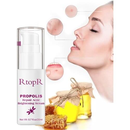 20ml Propolis Anti Acne Essence Liquid Repair Acne Brightening Serum Stock Solution Beautiful Skin Brighten White