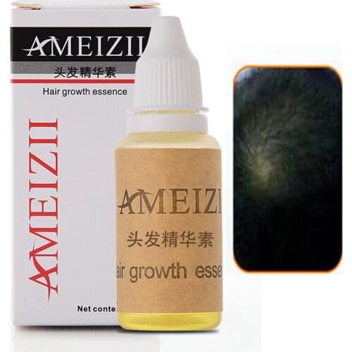 AMEIZII Ginger Hair Growth Anti Hair Loss Liquid 20ml Dense Hair Fast Sunburst Andrea Hair Growth Grow Alopecia