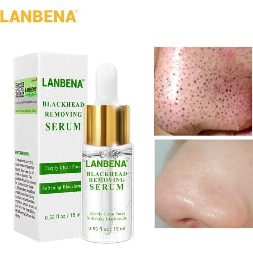 LANBENA Blackhead Removing Serum Acne Treatment Essence Deeply Clean Pores and Softening Blackheads Skin Face Care 15ml