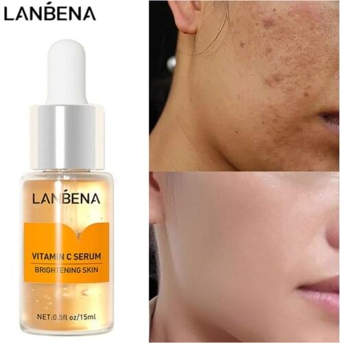LANBENA Vitamin C Whitening Serum Hyaluronic Acid Face Cream Snail Remover Freckle Speckle Fade Dark Spots Brighten Skin Care