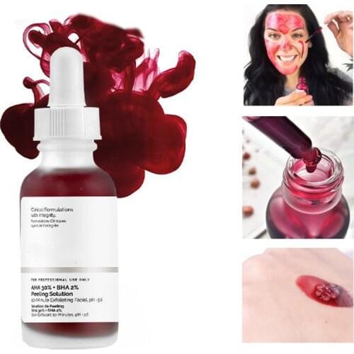 Mask Facial Serum AHA 30% + BHA 2% Peeling Solution Remove Acne Marks and Blackheads Salicylic Face Serum 30ml