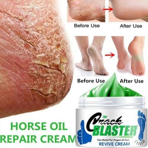 Effective Hand Foot Crack Cream Heel Chapped Peeling Repair Frostbite Anti Dry Skin Creams Nourishing Anti Cracking Repair Cream