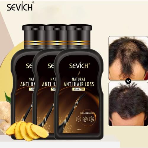 Sevich Natural Organic 500ML Anti Hair Loss Shampoo Ginger Hair Growth Plant Essence Gel Hair Loss Treatment Hair Care Shampoo