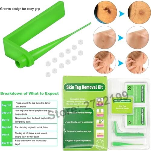 Groene Versie Huid Tag Remover Kit Micro Bands Wratten Verwijdering Machine Voor Huid Tag Remover Gezicht huidverzorging Salon