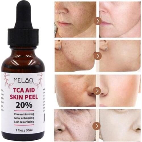 30ml Skin Peel Face Serum Shrink Pores Essence Facial Pore Minizing Wrinkles Remover Trichloroaectic Acid 20% Skin Care