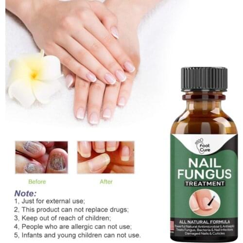 Foot Nail Repair Liquid Hand And Foot Onychomycosis Care Repair Onychomycosis Liquid Antibacterial Thickening Soft Nail Treat