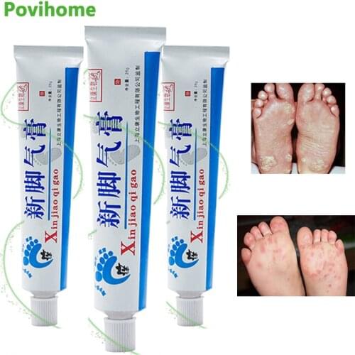 3Pcs Foot Cream Foot Corn Removal Athletes Erosive Beriberi Anti Itching Sweat Odor Feet Psoriasis Antibacterial Ointment P1028